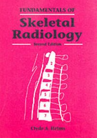 Produktbild: Fundamentals of Skeletal Radiology
