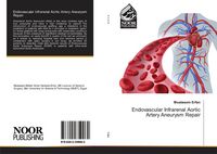 Produktbild: Endovascular Infrarenal Aortic Artery Aneurysm Repair