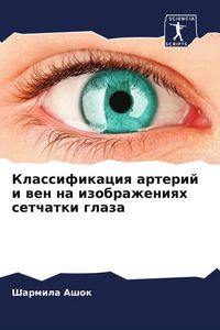 Produktbild: Klassifikaciq arterij i wen na izobrazheniqh setchatki glaza