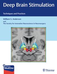 Produktbild: Deep Brain Stimulation