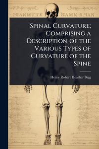 Produktbild: Spinal Curvature; Comprising a Description of the Various Types of Curvature of the Spine