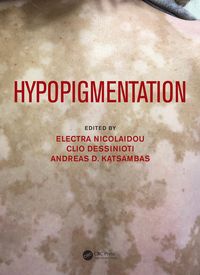 Produktbild: Hypopigmentation