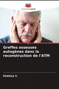 Produktbild: Greffes osseuses autog&egrave;nes dans la reconstruction de l'ATM