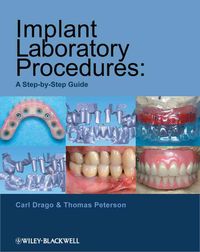 Produktbild: Implant Laboratory Procedures