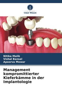 Produktbild: Management kompromittierter Kieferk&auml;mme in der Implantologie