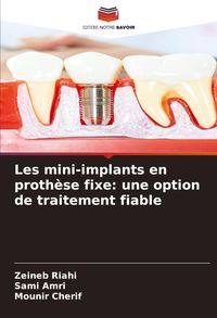 Produktbild: Les mini-implants en proth&egrave;se fixe: une option de traitement fiable