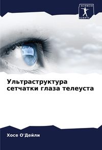 Produktbild: Ul'trastruktura setchatki glaza teleusta