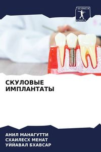 Produktbild: Skulovye Implantaty
