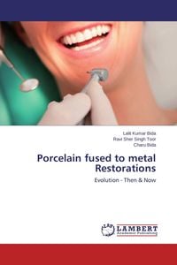 Produktbild: Porcelain fused to metal Restorations