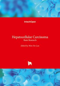 Produktbild: Hepatocellular Carcinoma