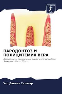 Produktbild: Parodontoz I Policitemiya Vera