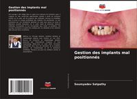 Produktbild: Gestion des implants mal positionn&eacute;s