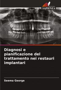 Produktbild: Diagnosi e pianificazione del trattamento nei restauri implantari