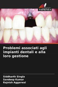 Produktbild: Problemi associati agli impianti dentali e alla loro gestione