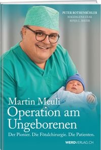 Produktbild: Martin Meuli - Operation am Ungeborenen