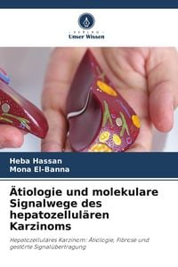 Produktbild: &Auml;tiologie und molekulare Signalwege des hepatozellul&auml;ren Karzinoms