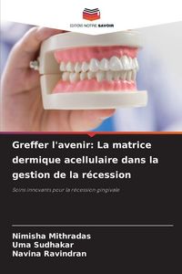 Produktbild: Greffer l'avenir: La matrice dermique acellulaire dans la gestion de la r&eacute;cession