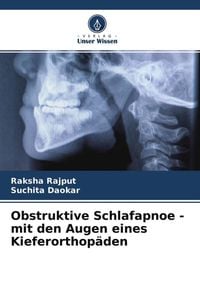Produktbild: Obstruktive Schlafapnoe - mit den Augen eines Kieferorthop&auml;den