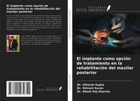 Produktbild: El implante como opci&oacute;n de tratamiento en la rehabilitaci&oacute;n del maxilar posterior