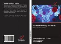 Produktbild: Guz&oacute;w macicy u kobiet
