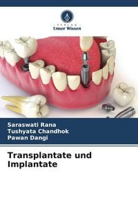 Produktbild: Transplantate und Implantate