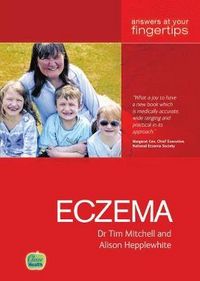 Produktbild: Mitchell, T: Eczema AYF