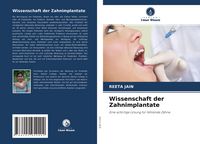 Produktbild: Wissenschaft der Zahnimplantate