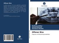 Produktbild: Offener Biss