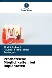 Produktbild: Prothetische M&ouml;glichkeiten bei Implantaten