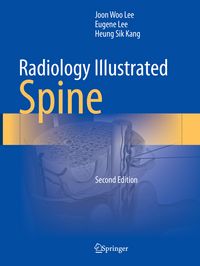 Produktbild: Radiology Illustrated: Spine