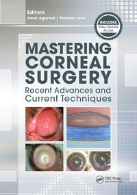 Produktbild: Mastering Corneal Surgery