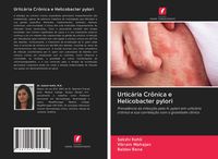 Produktbild: Urtic&aacute;ria Cr&ocirc;nica e Helicobacter pylori