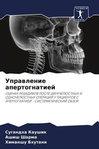 Produktbild: Uprawlenie apertognatiej