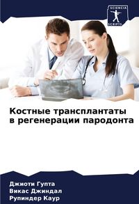 Produktbild: Kostnye transplantaty w regeneracii parodonta