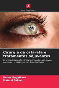 Produktbild: Cirurgia da catarata e tratamentos adjuvantes