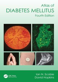 Produktbild: Atlas of Diabetes Mellitus