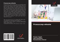 Produktbild: Przeszczep w&iquest;os&oacute;w