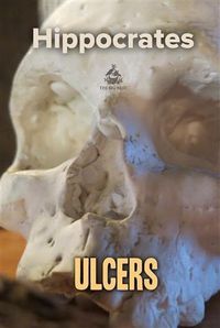 Produktbild: Ulcers