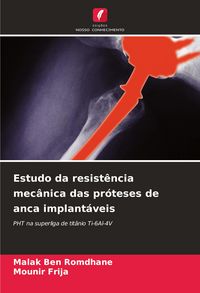 Produktbild: Estudo da resist&ecirc;ncia mec&acirc;nica das pr&oacute;teses de anca implant&aacute;veis