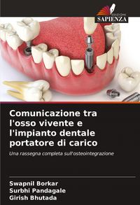 Produktbild: Comunicazione tra l'osso vivente e l'impianto dentale portatore di carico