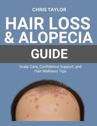 Produktbild: Hair Loss & Alopecia Guide