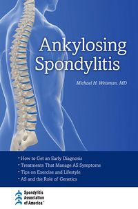 Produktbild: Ankylosing Spondylitis
