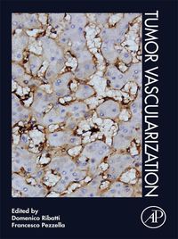 Produktbild: Tumor Vascularization