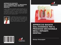 Produktbild: Approccio Basato Sull'evidenza Per Il Processo Decisionale Negli Impianti Dentali