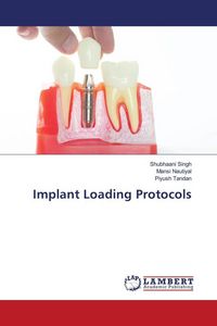 Produktbild: Implant Loading Protocols