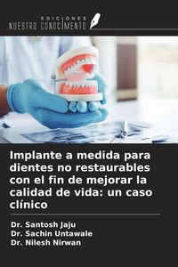 Produktbild: Implante a medida para dientes no restaurables con el fin de mejorar la calidad de vida: un caso cl&iacute;nico