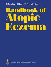 Produktbild: Handbook of Atopic Eczema