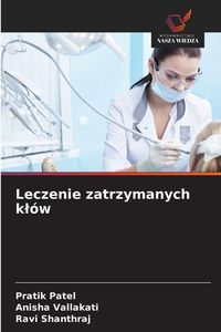 Produktbild: Leczenie zatrzymanych k&iquest;&oacute;w