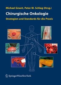 Produktbild: Chirurgische Onkologie