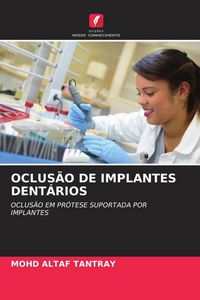 Produktbild: Oclus&atilde;o De Implantes Dent&aacute;rios